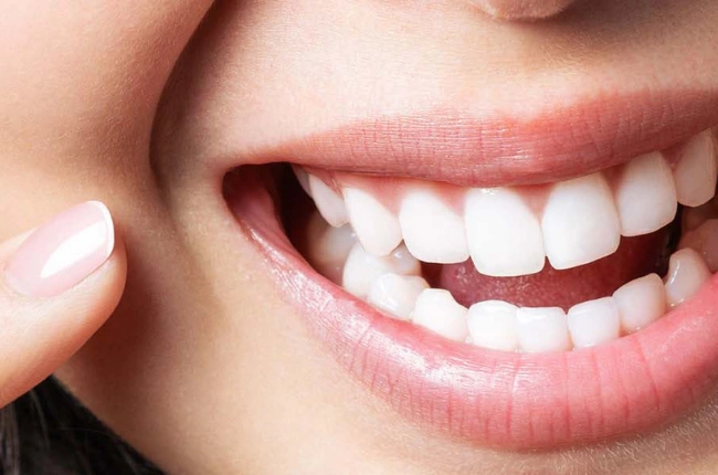 Konya Dijital Gülüş Tasarımı