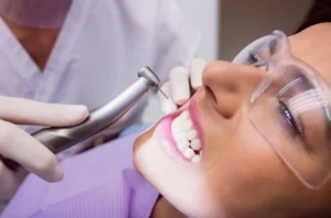 Konya Diş Taşı Temizliği